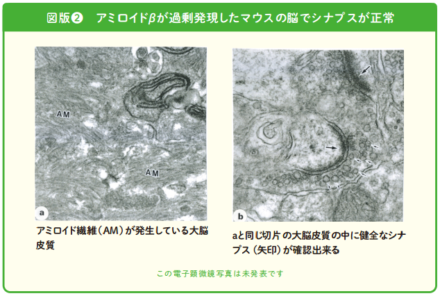 【悲報】糖化が老化を加速させるんやが…