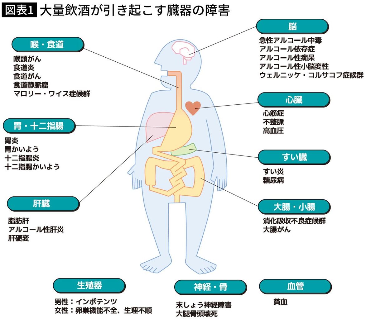 【悲報】酒税が甘すぎる問題、医師がマジ激怒やん！