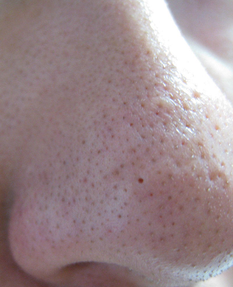 画像ありいちご鼻 32穴目 毛穴 化粧板速報 2chまとめ 口コミ