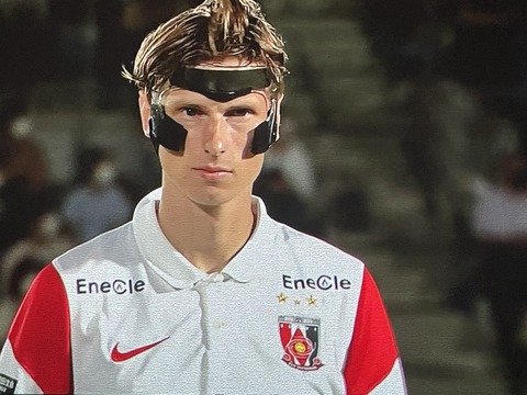 サッカーばっかり 画像 頬骨骨折 浦和レッズfwユンカーのフェイスガードが聖闘士星矢っぽいと話題に J1 第25節 徳島 浦和 サッカーばっかり 画像 頬骨骨折 浦和レッズfwユンカーのフェイスガードが聖闘士星矢っぽいと話題に J1 第25節 徳島 浦和