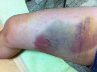 あ 足が 館長のつぶやきdiary