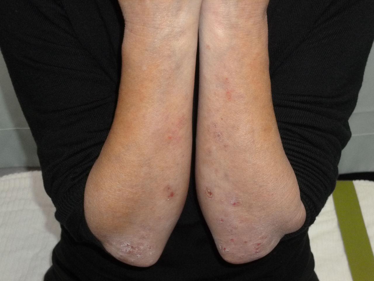 治療日誌ブログ Livedoor Blog ブログ