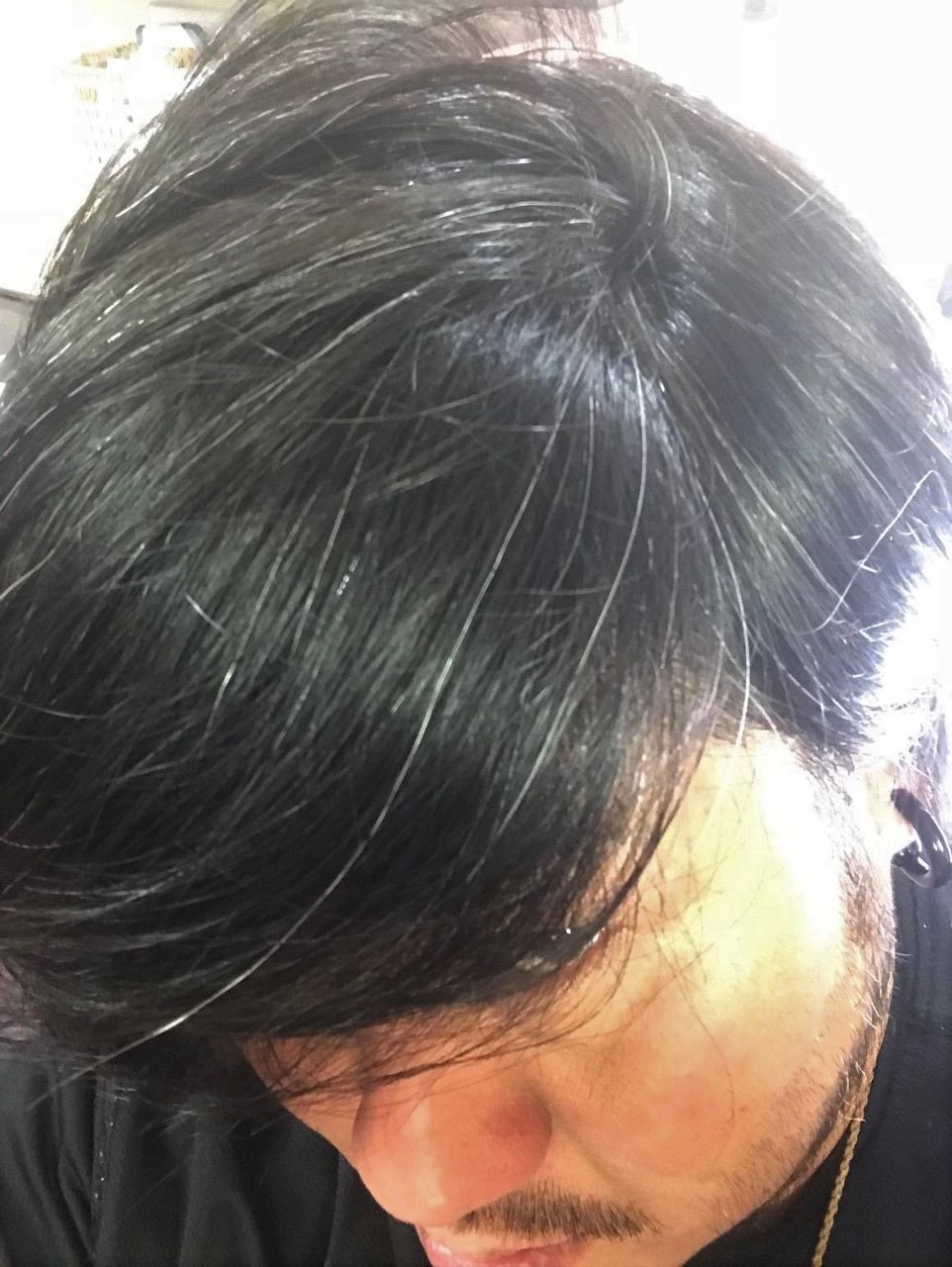 白髪や脱毛 頭皮の色で見る身体の不調 Hair Make Kiaora 脱毛症や薄毛 白髪でお悩みの方専門 白髪や脱毛 頭皮の色で見る身体の不調 Hair Make Kiaora 脱毛症や薄毛 白髪でお悩みの方専門