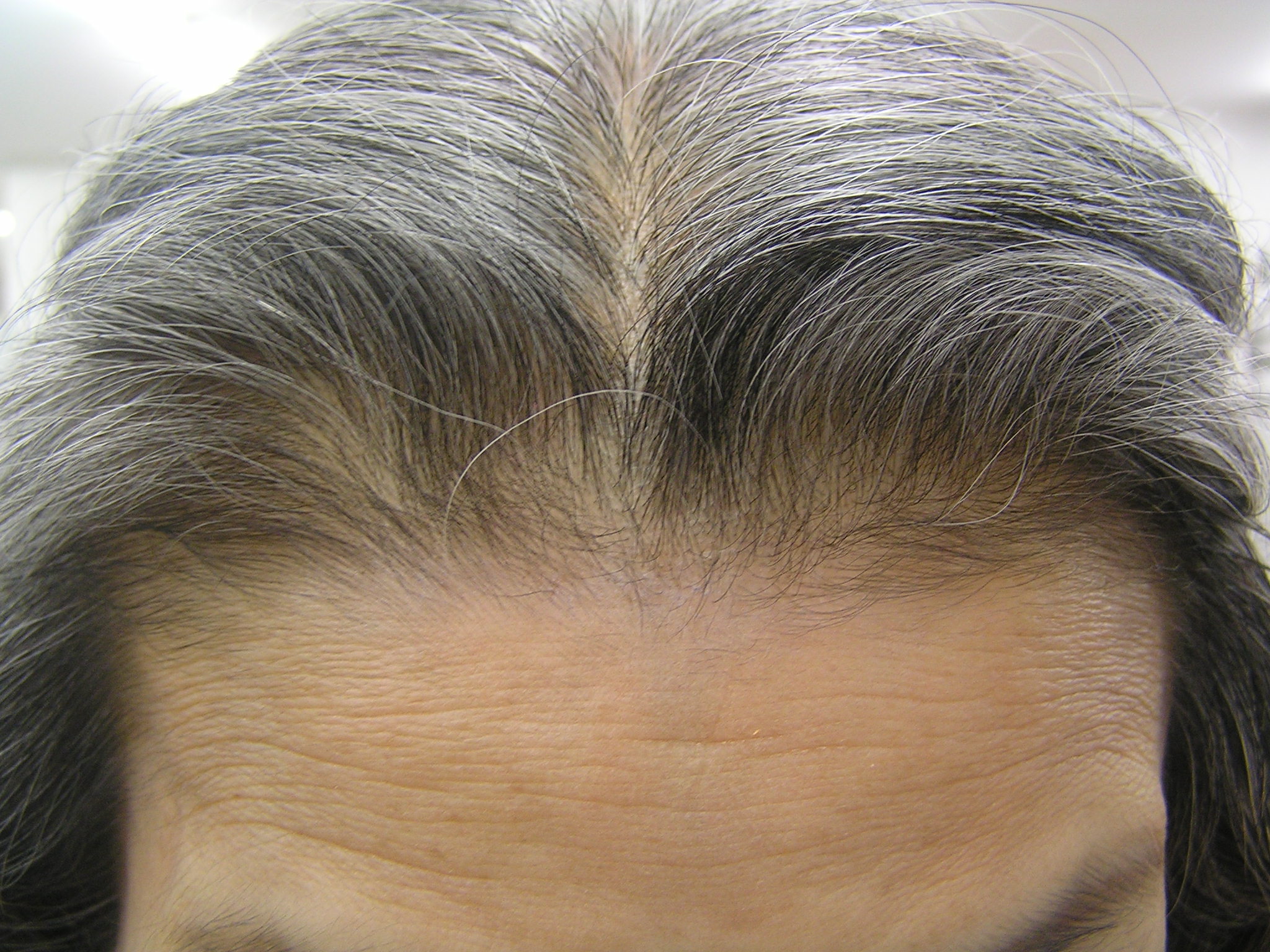 白髪の根元から黒毛が発毛 美と健康の 加圧トレーニング ブログ