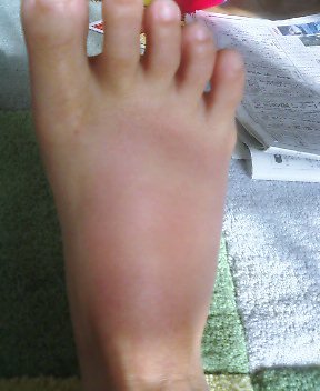 ボンツコ蚊 ウサギのしっぽ 彡