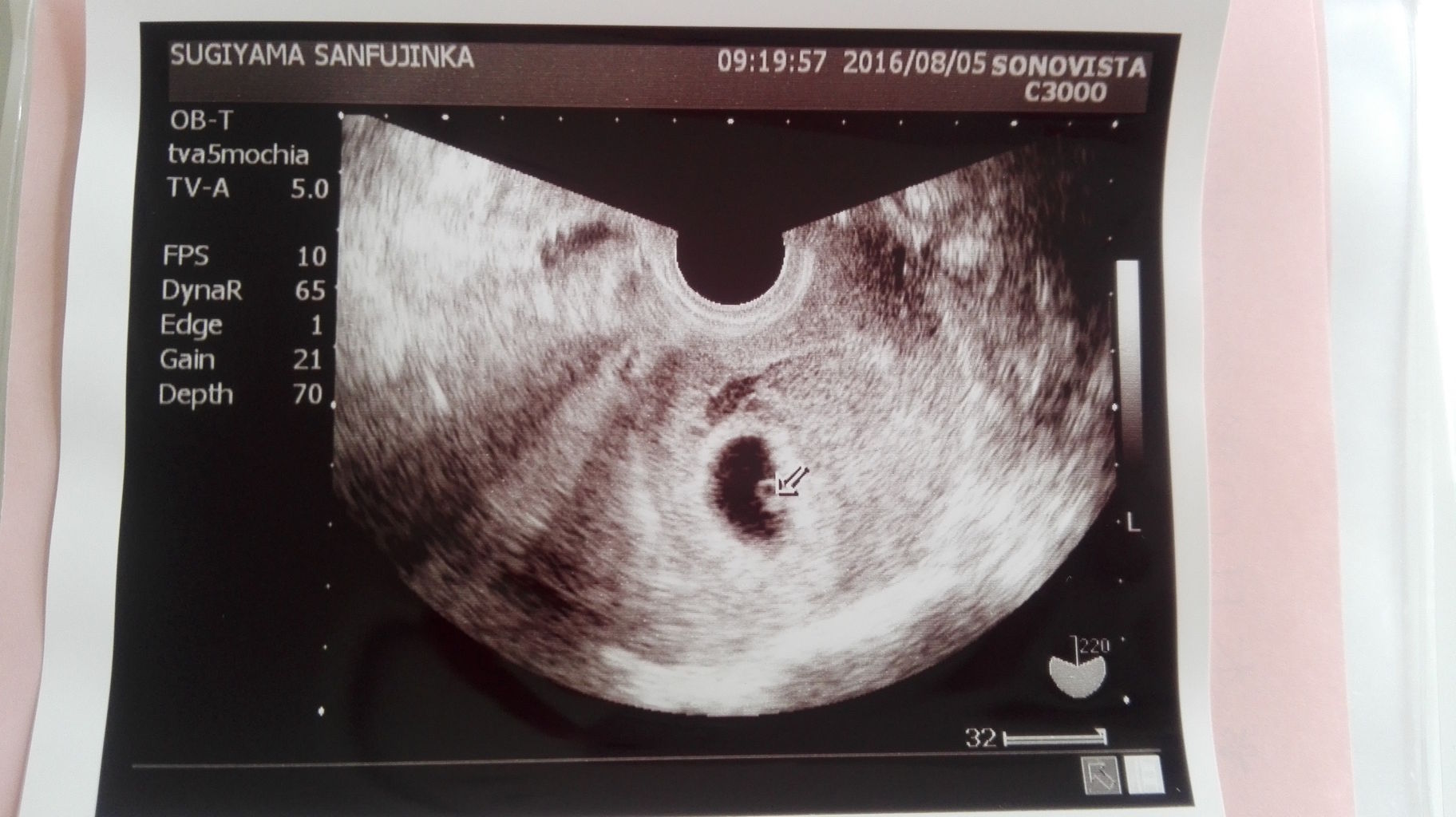 8w4d みなさんへ お久しぶりになってしまいました おいしい妊活diary