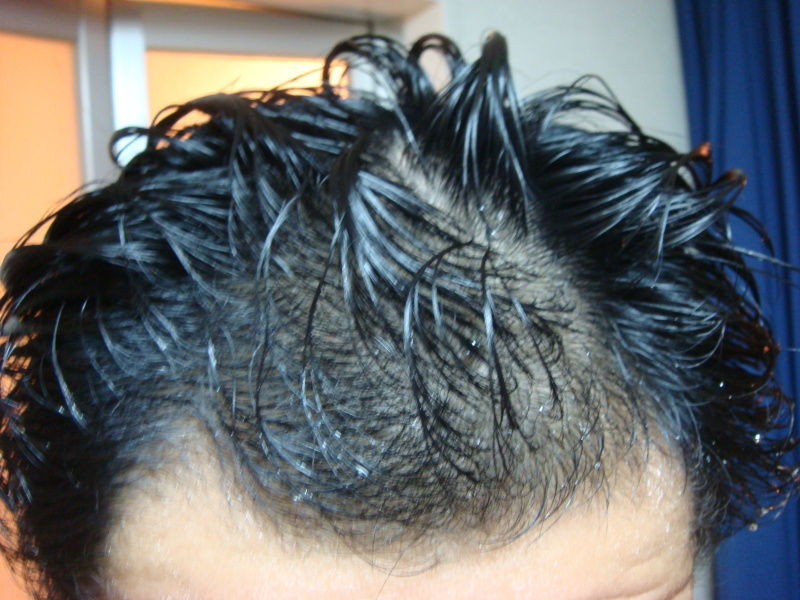 実況 あっーと ここでワイ軍の前髪 後退守備を取ります 解説 うーん まだ23歳なんですがねぇ つー速