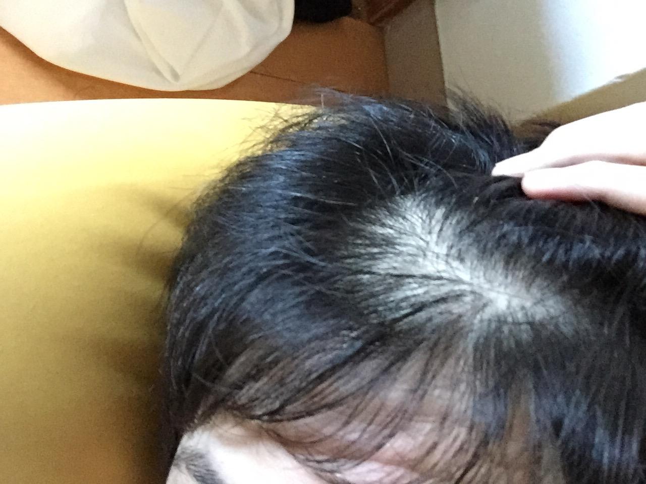 実況 あっーと ここでワイ軍の前髪 後退守備を取ります 解説 うーん まだ23歳なんですがねぇ つー速