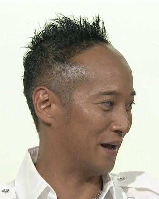 放送事故級の 髪ングアウト 中居くんの不自然な頭髪に悲鳴 ガールズちゃんねる 放送事故級の 髪ングアウト 中居くんの不自然な頭髪に悲鳴 ガールズちゃんねる