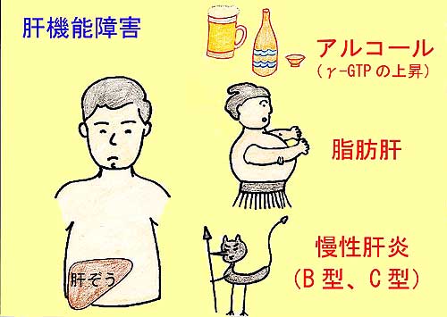 腹水の漢方対策 腹水の症状と治療についての纏め 腹水の漢方治療 腹水の原因 症状 治療法について 腹水の漢方対策 腹水の症状と治療についての纏め 腹水の漢方治療 腹水の原因 症状 治療法について