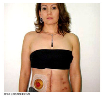 20110129_mexican_police3