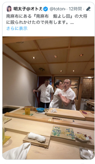 腕時計の画像