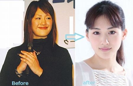 綾瀬はるかもダレノガレ明美も 昔太っていた女性芸能人 にゅーすなちゃんねる 綾瀬はるかもダレノガレ明美も 昔太っていた女性芸能人 にゅーすなちゃんねる