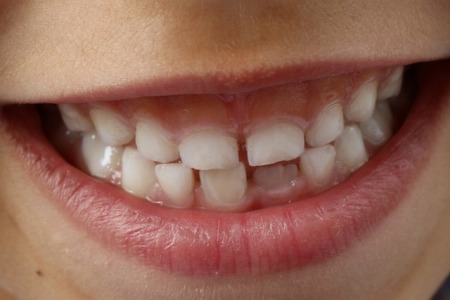 s-teeth-gf42cc7d61_640