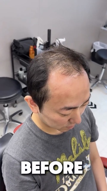 yiU9G6y - Imgur