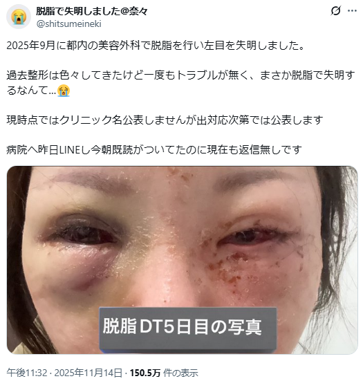 スクリーンショット 2025-11-19 100324