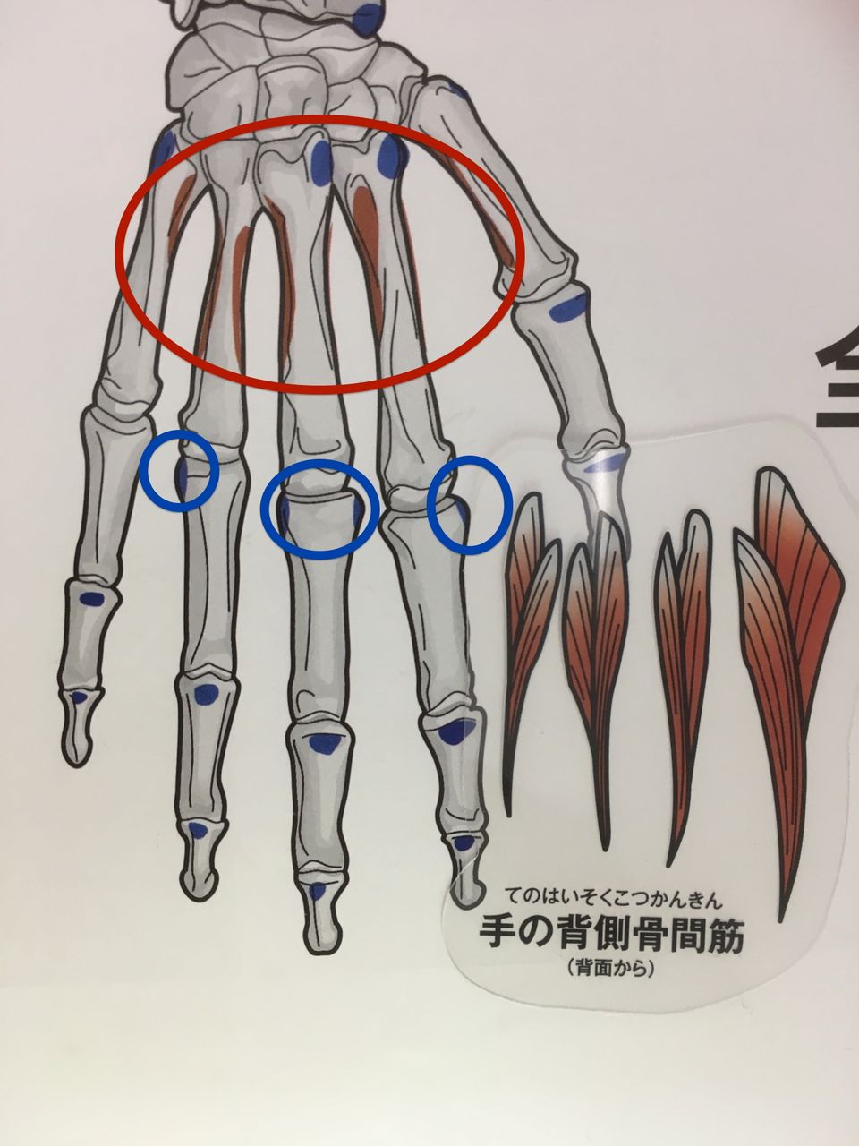 からだの白地図を実際に使ってみよう 手の背側骨間筋編44 福岡で筋膜のことなら筋膜 温熱療法院へ からだの白地図を実際に使ってみよう 手の背側骨間筋編44 福岡で筋膜のことなら筋膜 温熱療法院へ