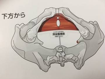 93-1