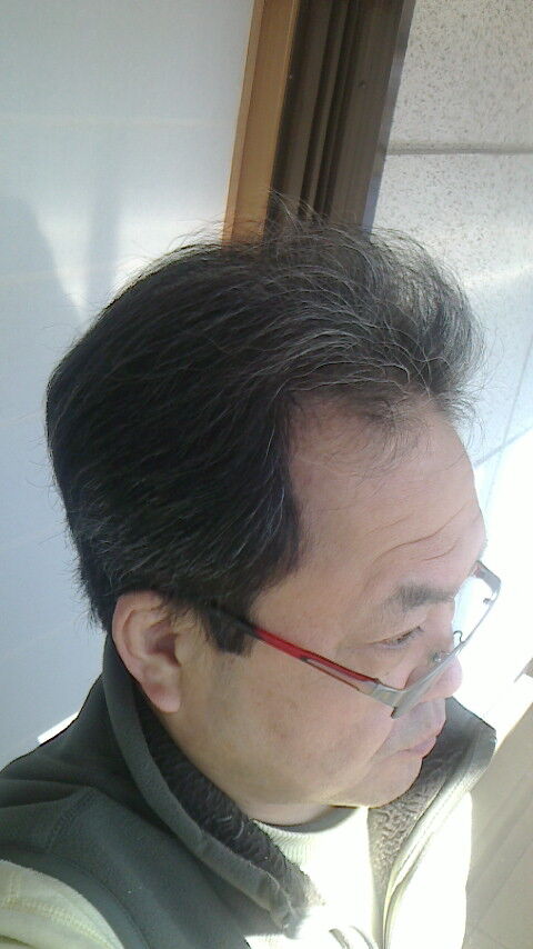 PIC00000A