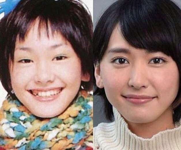整形失敗だろ と思う芸能人 芸能まとめ速報 整形失敗だろ と思う芸能人 芸能まとめ速報