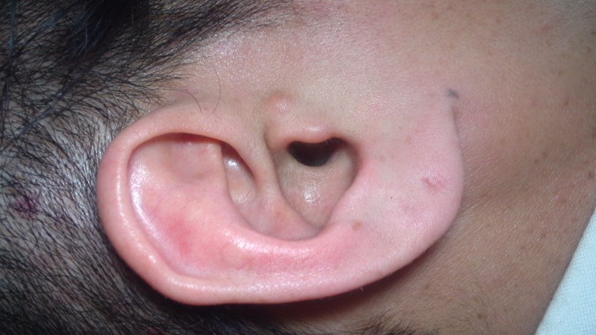 e410bfb1.jpg