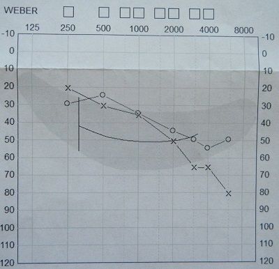 audiogram2016may