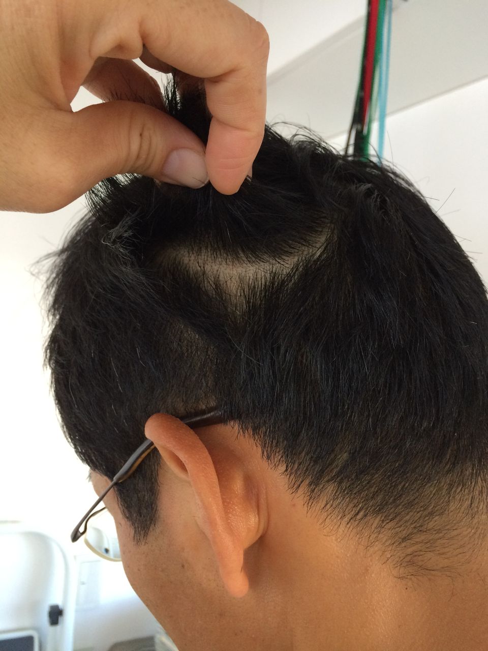 ありがとう あんまさん 円形脱毛症 医者とあんまのブルースhttp Www Kishodo Net