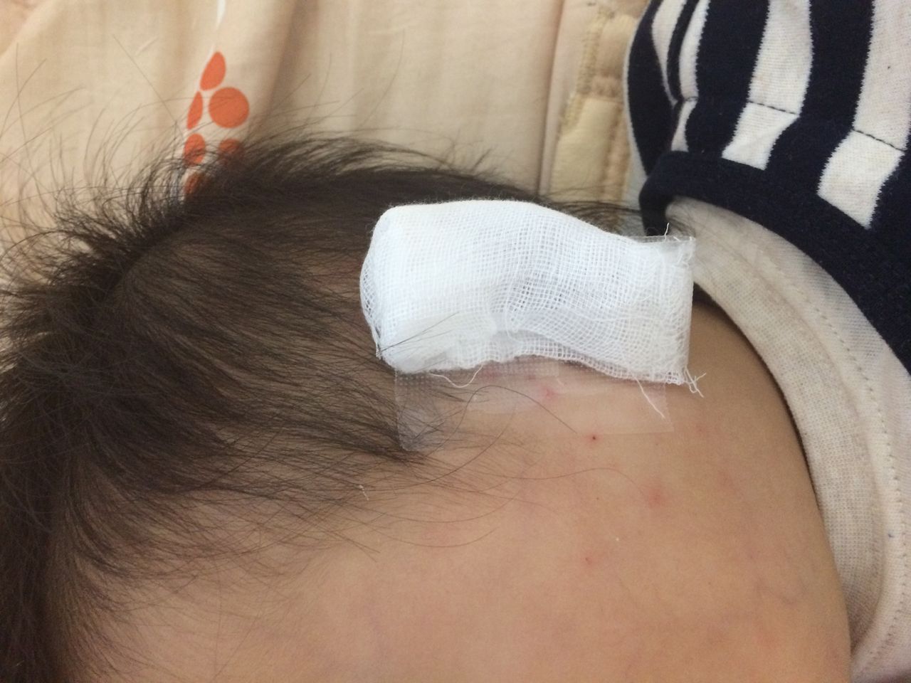 子供の耳をガーゼで覆う時の３つの注意点 会社は犬に論語