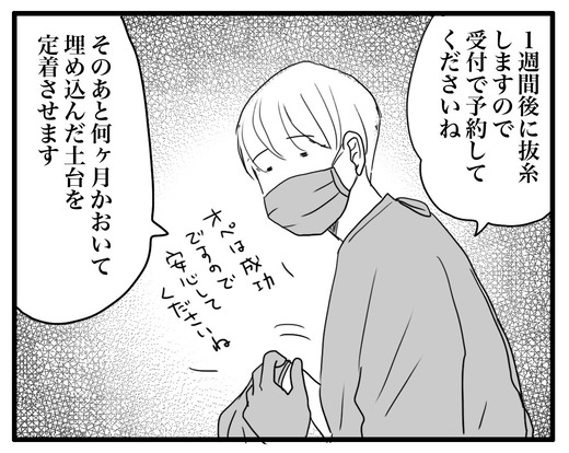 インプラント3のコピー
