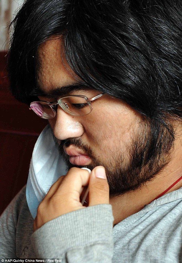 画像あり 薬の副作用で あんな所 が剛毛になってしまった16歳少女 気になる 気になる ニュース速報