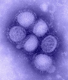 225px-H1N1_influenza_virus