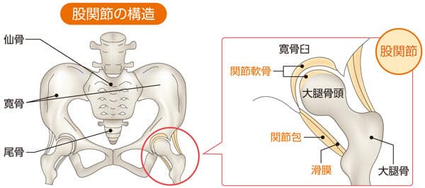 歩くとき 股関節には体重の何倍の負荷 フィリピン ネグロス島 主にバコロド の話