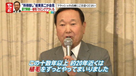 坂東英二の7500万円脱税は植毛代 小倉さんの とくダネ コメントは 動画あり バブル経験が忘れられないキウイ世代の日常