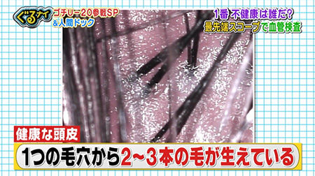 薄毛治療は病院で専門医に相談して方向性を定めてから バブル経験が忘れられないキウイ世代の日常 薄毛治療は病院で専門医に相談して方向性を定めてから バブル経験が忘れられないキウイ世代の日常