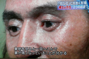 鼻根 外見上 縄文人と弥生人をわけるもの 民族学伝承ひろいあげ辞典