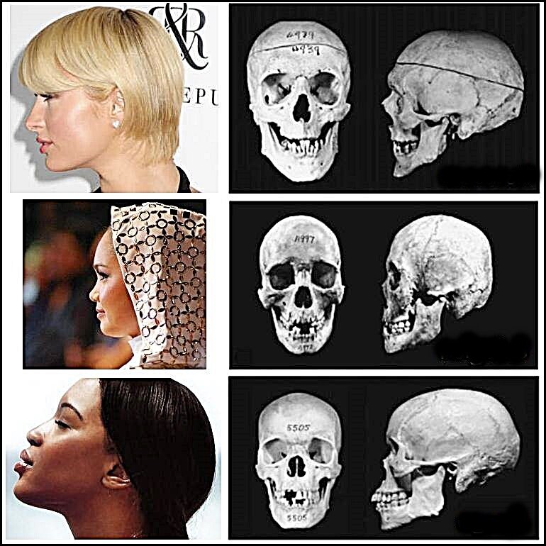 民族別骨格の面白さ 民族学伝承ひろいあげ辞典