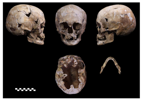 jyoumonjin-genomu-01