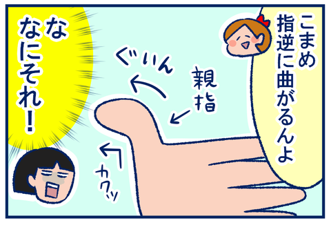 指が反る人の骨の仕組みがわからない 双子を授かっちゃいましたヨ 記事コメント 1 Powered By ライブドアブログ 指が反る人の骨の仕組みがわからない 双子を授かっちゃいましたヨ 記事コメント 1 Powered By ライブドアブログ