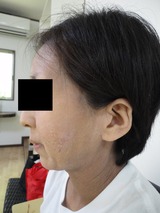 DSC00866