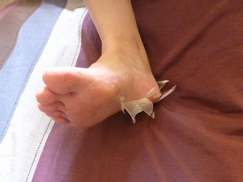 足裏角質 こん助の雑記