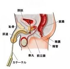 R18 尿道カテーテル 禁断症状 Under The Blue Moon 稀有な時の下で