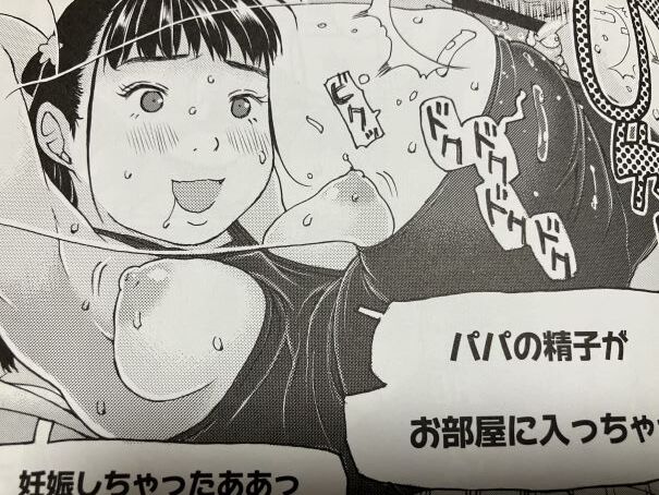 2024y801eromangacc047