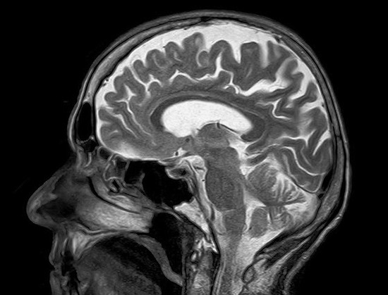 mri-782459_640