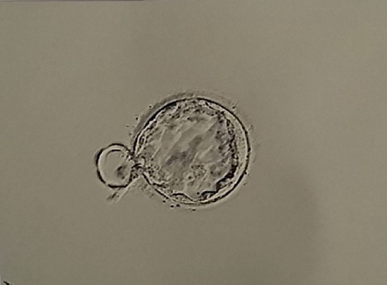 【研究】米英の研究チーム、受精を経ずヒト胚「のようなもの」を作製 - コノユビニュース|みんなの反応まとめ