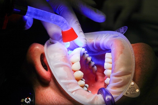 dentist-1864921_960_720