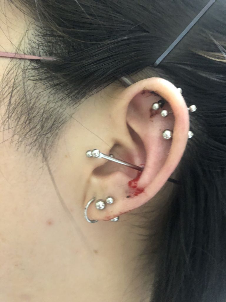インナーコンクとロブ開けた ピアス日記 インナーコンクとロブ開けた ピアス日記