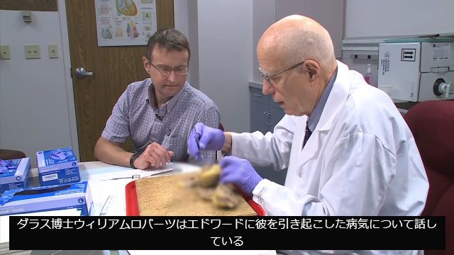 【閲覧注意】心臓移植で取り出した自分の心臓を見つつ、どういう疾患だったのか医師から説明を受ける男性