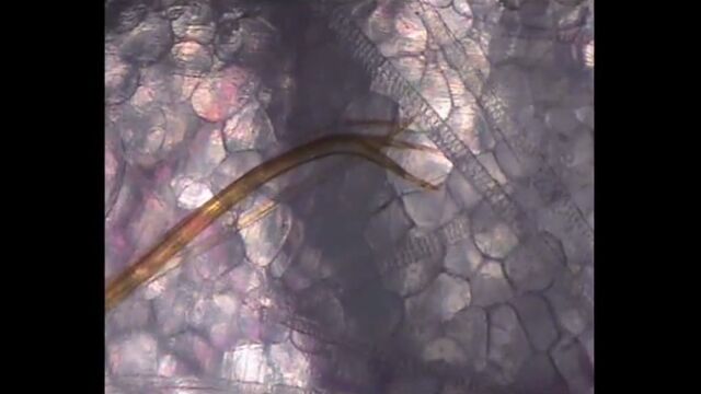 皮膚から体内に突き刺さる、蚊の口吻を観察した映像