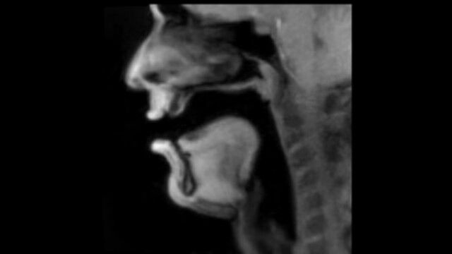 �ҥ塼�ޥ󡦥ӡ��ȥܥå�������Ȥ��ݸ����ˡ�MRI�Ǹ�����ͻҤ�ꥢ�륿����˻��Ƥ������̿ޤ�����