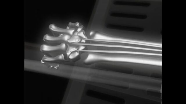 ������3�ܤοϤ����ӽФ�X-MEN�Υ����ѡ��ҡ������������������X�������äƤ���ʴ���